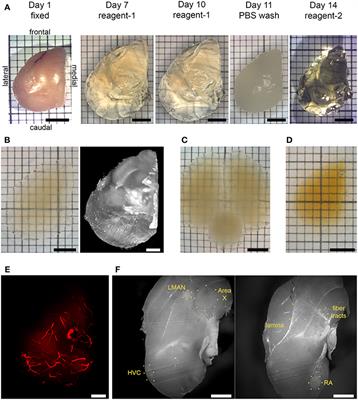 Tissue Clearing and Light Sheet Microscopy: Imaging the Unsectioned Adult Zebra Finch Brain at Cellular Resolution